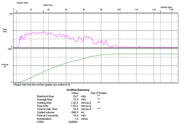 Uroflowmetry Chart Example